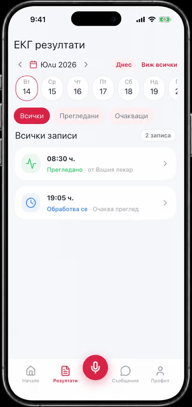Преглед на резултат в приложението CardiSong